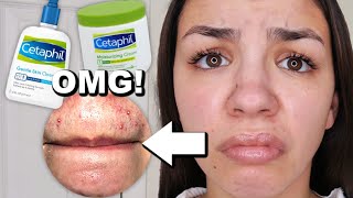 I Used Cetaphil Skincare For One Week [upl. by Crocker]