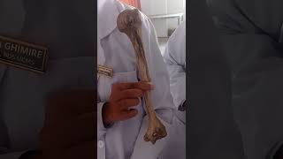 side determination and parts of humerus bone humerus bone medicalstudent anatomy shorts [upl. by Barnebas]