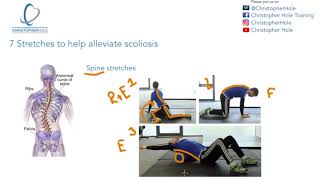 7 stretches to help alleviate scoliosis [upl. by Ellenig631]