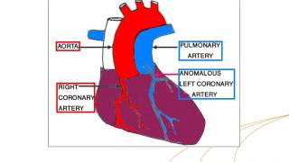 IAEAESNM Webinar  Myocardial Perfusion Scintigraphy in Paediatric Cardiology [upl. by Faye262]