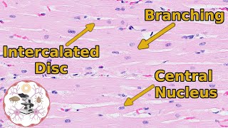 Heart Histology  Valveuable Insights [upl. by Willmert930]