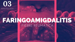 Faringoamigdalitis y Fiebre reumática  ENARM [upl. by Annasiul]