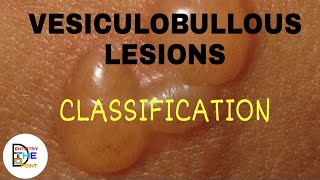 VESICULOBULLOUS LESIONS CLASSIFICATION [upl. by Marybella169]