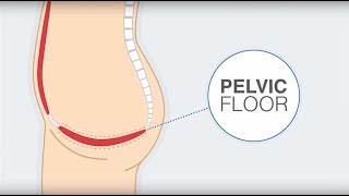 Interstitial Cystitis  Physiotherapy 35 [upl. by Faxen]