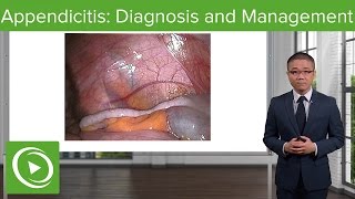 Appendicitis Diagnosis and Management – General Surgery  Lecturio [upl. by Eyla]