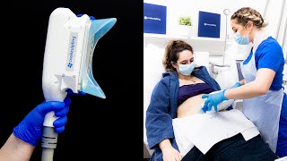 Is CoolSculpting worth it  Before and After Results [upl. by Cost595]