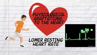 BIOM4180  Sinus Bradycardia [upl. by Llenrev]