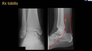 Anatomía Rx Tobillo [upl. by Niac797]