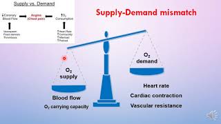 Treatment of angina [upl. by Elberta636]