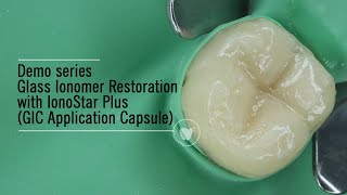 IonoStar Plus VOCO  Glass Ionomer Restoration  GIC Application Capsule [upl. by Halik151]