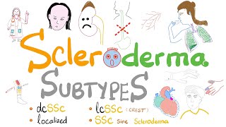 Scleroderma Subtypes 5 Types of Systemic Sclerosis incl Limited vs Diffuse Scleroderma [upl. by Rovaert]