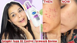 Cetaphil Oil Control Foam Face Wash  Best Face Wash For Acne Prone Skin [upl. by Secnarfyram]