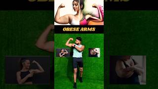 Obese arms workout no equipment fitness tipsmotivation fatloss challenge shortvideo trending [upl. by Teddman]