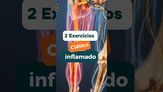 Ciático inflamado 2 exercícios coluna ciatico fisioprev [upl. by Critta]