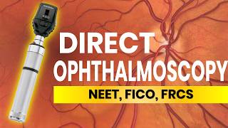 Direct Ophthalmoscopy Tips and Tricks [upl. by Eintrok]