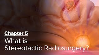 What is Stereotactic Radiosurgery Chapter 5 — Brain Metastases A Documentary [upl. by Aisak]