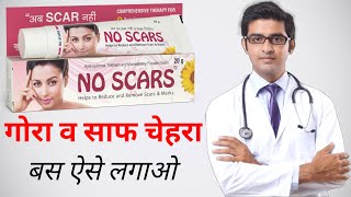 No Scars Cream Review  how to use no scars cream फायदे और नुकसान [upl. by Soren203]