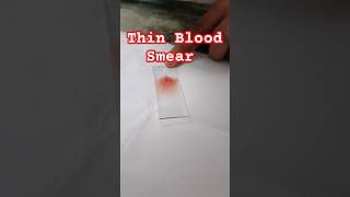 How to make peripheral thin blood smear smear blood staining microscopy hematology shorts [upl. by Wylie]