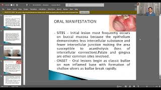 VESICULOBULLOUS LESIONS OF ORAL CAVITY BY Dr JEENA SEBASTIAN  DEPT OF ORAL MEDICINE AND RADIOLOGY [upl. by Colligan]