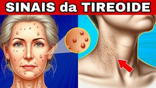 🚨 8 SINAIS de ALERTA da TIREOIDE Hipotireoidismo e Hipertireoidismo [upl. by Andre]