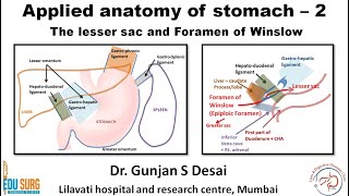 Lesser sac and foramen of Winslow  Applied anatomy of stomach part 2 [upl. by Agnimod]