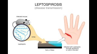 Understanding Leptospirosis Symptoms and Treatment  Expert Guide [upl. by Ardnusal]