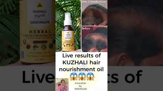 குழலி மூலிகை கூந்தல் எண்ணெய் 3 மாதத்தில் நல்ல மாற்றம்  Live results of my Kuzhali hair oil [upl. by Ciredor]