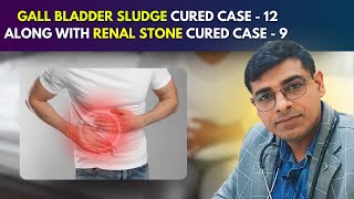 Gall Bladder Sludge Cured Case  12 Along With Renal Stone Cured Case  9  Dr Abhik Ghosh [upl. by Ames]