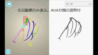 CAG angle simulator [upl. by Mord]