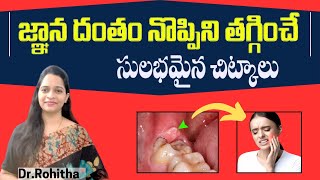 జ్ఞాన దంతం నొప్పికి  Pericoronitis  Causes Symptoms  treatment and Home Remedies in Telugu [upl. by Llehsyt]