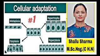 Cellular Adaptation TypesAtrophy HypertrophyPhysiological and pathological Atrophy [upl. by Desi]