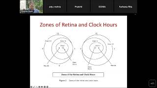 Retinopathy of Prematurity ROP [upl. by Serge]