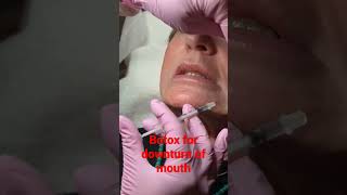 Botox for downturn of the mouth to lift corners [upl. by Notniuq]