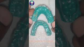 Maxillary  Mandible  Essix Retainer  Hard Splint 15  Tamil Dental Lab  viralvideo dentalcare [upl. by Simon]