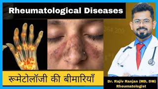 रूमेटोलॉजी की बीमारिया  Common Rheumatological Diseases [upl. by Emyam167]