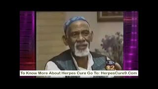 Dr Sebi On Herpes Cure  Natural Cure For Herpes By Dr Sebi [upl. by Nalliuq]