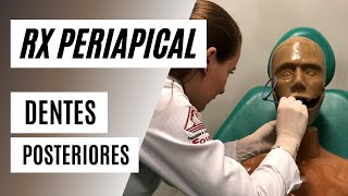 Como radiografar dentes posteriores com posicionador  Técnica periapical [upl. by Mimi]