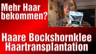 Bockshornklee Nach Haartransplantation Erfahrung Franky Haare Medical Exclusive Türkei [upl. by Anelegna]