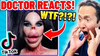 Plastic Surgeon Reacts to BOTCHED Plastic Surgery TikTok Videos [upl. by Uot]