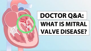 Mitral Valve Disease Awareness What Is Mitral Valve Disease [upl. by Yeznil]