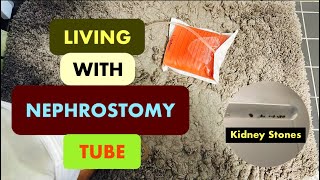 Nephrostomy Tube  Nefrostomi  Nephrostomy Journey  Nephrostomy Tube Care  Nephrostomy Tips [upl. by Lyon725]