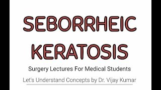 Seborrheic Keratosis  Basal Cell Papilloma  Seborrheic Keratosis Removal  Surgery Lectures [upl. by Barvick760]