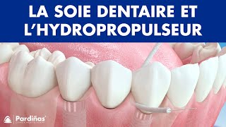 Soie dentaire et l’hydropropulseur — Méthodes de nettoyages des implants © [upl. by Tj586]