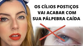 COMO CORRIGIR PTOSE SEM CIRURGIA😱ESSA DICA É INCRÍVELptosepalpebral cirurgiadaspalpebras [upl. by Dow]