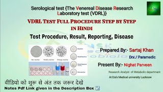 vdrl test principal and full procedure  Vdrl disease serological test in laboratory  vdrl test mlt [upl. by Elane289]