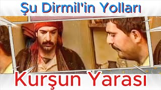 ŞU DİRMİLİN YOLLARI  KURŞUN YARASI [upl. by Assyl]