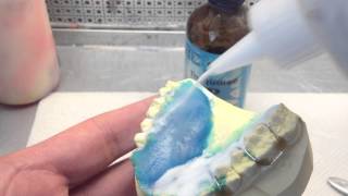 Acrylic Application on a Retainer Salt and Pepper Method [upl. by Klemperer]