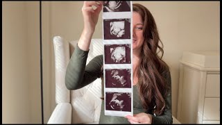 Second Trimester Recap echogenic bowel anxiety praying through pregnancy [upl. by Zsa Zsa901]