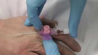 Cannulation How to gain IV access [upl. by Lunette]