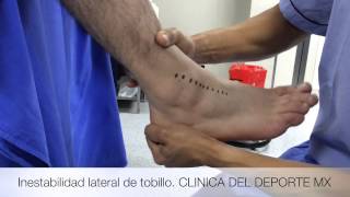 Inestabilidad lateral del tobillo [upl. by Leesen]